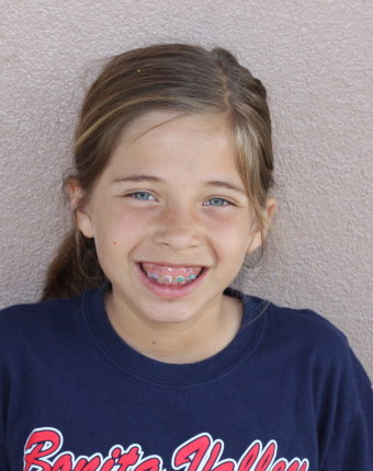 Abby
